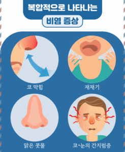 봄철 비염 및 알러지 증상 완화법 간략 정리!
